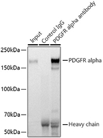 PDGFRA Antibody in Immunoprecipitation (IP)