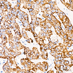 CHDH Antibody in Immunohistochemistry (Paraffin) (IHC (P))