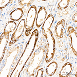 CHDH Antibody in Immunohistochemistry (Paraffin) (IHC (P))