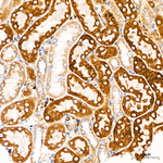 CHDH Antibody in Immunohistochemistry (Paraffin) (IHC (P))
