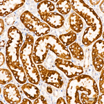 CHDH Antibody in Immunohistochemistry (Paraffin) (IHC (P))
