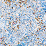 MLKL Antibody in Immunohistochemistry (Paraffin) (IHC (P))