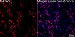 Gata-3 Antibody in Immunohistochemistry (Paraffin) (IHC (P))