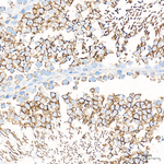 COX1 Antibody in Immunohistochemistry (Paraffin) (IHC (P))