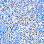 Aurora B Antibody in Immunohistochemistry (Paraffin) (IHC (P))