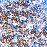 Aurora B Antibody in Immunohistochemistry (Paraffin) (IHC (P))