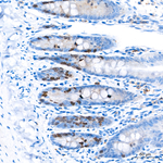 Aurora B Antibody in Immunohistochemistry (Paraffin) (IHC (P))