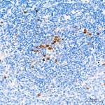 Aurora B Antibody in Immunohistochemistry (Paraffin) (IHC (P))