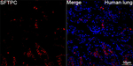 SFTPC Antibody in Immunohistochemistry (Paraffin) (IHC (P))