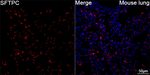 SFTPC Recombinant Rabbit Monoclonal Antibody (10P8V1)