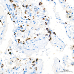 SFTPC Antibody in Immunohistochemistry (Paraffin) (IHC (P))