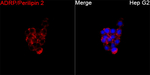 ADFP Recombinant Rabbit Monoclonal Antibody (1Y9G7)