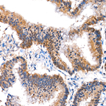 AMPK alpha-1,2 Recombinant Mouse Monoclonal Antibody (8G6E9)