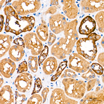 AMPK alpha-1,2 Antibody in Immunohistochemistry (Paraffin) (IHC (P))