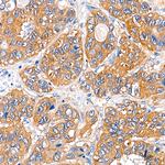 AMPK alpha-1,2 Antibody in Immunohistochemistry (Paraffin) (IHC (P))