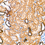 AMPK alpha-1,2 Antibody in Immunohistochemistry (Paraffin) (IHC (P))