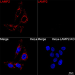 LAMP2 Recombinant Rabbit Monoclonal Antibody (6L8R5)