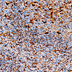 LAMP2 Antibody in Immunohistochemistry (Paraffin) (IHC (P))