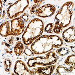 LAMP2 Antibody in Immunohistochemistry (Paraffin) (IHC (P))