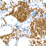 EPB41 Recombinant Rabbit Monoclonal Antibody (10F9S5)