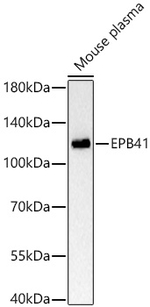 EPB41 Antibody in Western Blot (WB)