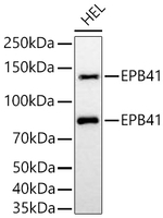 EPB41 Antibody in Western Blot (WB)