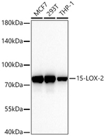 ALOX15B Antibody in Western Blot (WB)