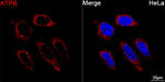 ATP Synthase beta Antibody in Immunocytochemistry (ICC/IF)