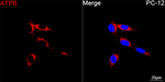 ATP Synthase beta Antibody in Immunocytochemistry (ICC/IF)
