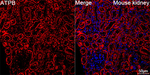 ATP Synthase beta Antibody in Immunohistochemistry (Paraffin) (IHC (P))