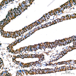 ATP Synthase beta Antibody in Immunohistochemistry (Paraffin) (IHC (P))