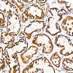 ATP Synthase beta Antibody in Immunohistochemistry (Paraffin) (IHC (P))