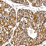 ATP Synthase beta Antibody in Immunohistochemistry (Paraffin) (IHC (P))
