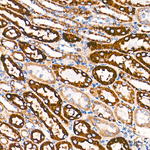 ATP Synthase beta Antibody in Immunohistochemistry (Paraffin) (IHC (P))