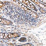 ATP Synthase beta Antibody in Immunohistochemistry (Paraffin) (IHC (P))