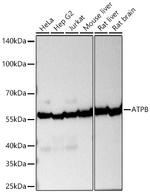ATP Synthase beta Antibody in Western Blot (WB)