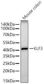 KLF3 Recombinant Rabbit Monoclonal Antibody (4U8A10)