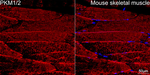 PKM1/PKM2 Antibody in Immunohistochemistry (Paraffin) (IHC (P))
