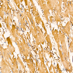 PKM1/PKM2 Antibody in Immunohistochemistry (Paraffin) (IHC (P))