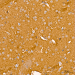 PKM1/PKM2 Antibody in Immunohistochemistry (Paraffin) (IHC (P))