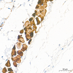 PKM1/PKM2 Antibody in Immunohistochemistry (Paraffin) (IHC (P))