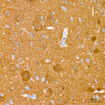 PKM1/PKM2 Antibody in Immunohistochemistry (Paraffin) (IHC (P))