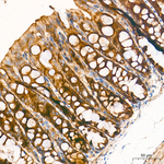 MBTPS1 Recombinant Rabbit Monoclonal Antibody (4V4Y7)