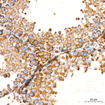 MBTPS1 Antibody in Immunohistochemistry (Paraffin) (IHC (P))
