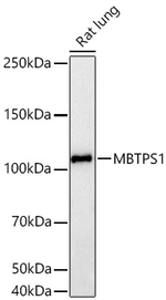 MBTPS1 Antibody in Western Blot (WB)
