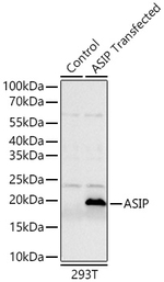 ASIP Recombinant Rabbit Monoclonal Antibody (0H7V9)