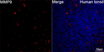 MMP9 Antibody in Immunohistochemistry (Paraffin) (IHC (P))