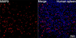 MMP9 Recombinant Rabbit Monoclonal Antibody (7C3P5)