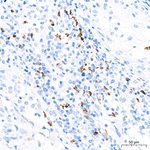 MMP9 Antibody in Immunohistochemistry (Paraffin) (IHC (P))