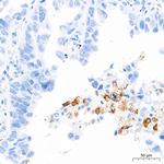 MMP9 Antibody in Immunohistochemistry (Paraffin) (IHC (P))
